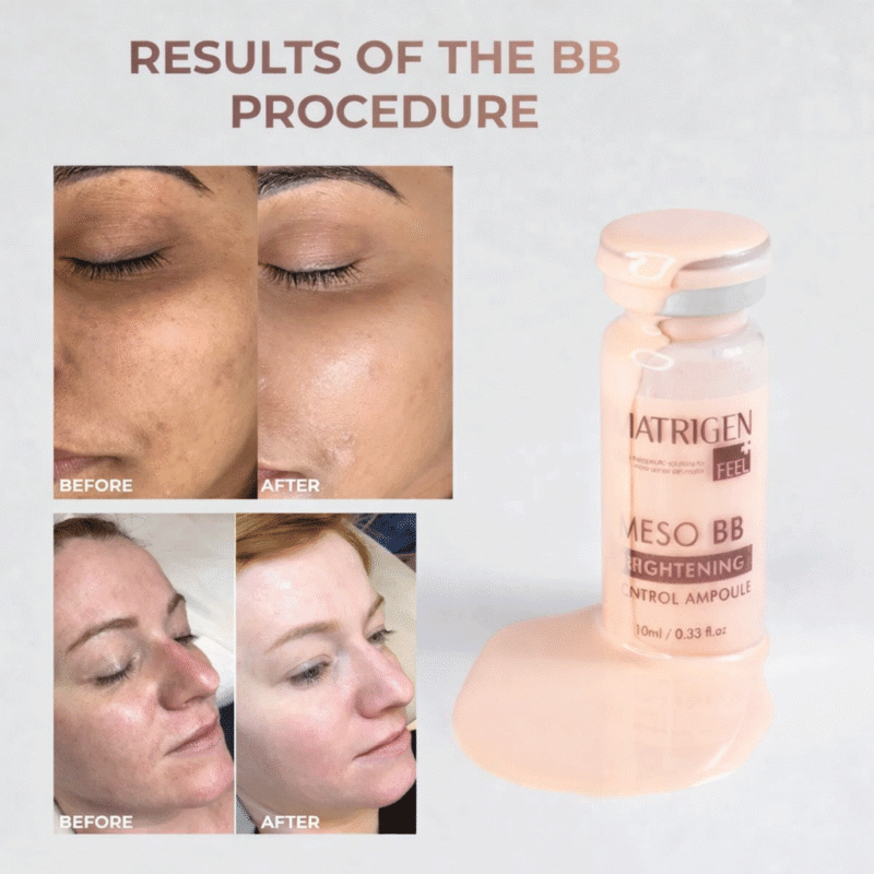 Matrigen Meso BB Brightening Control System